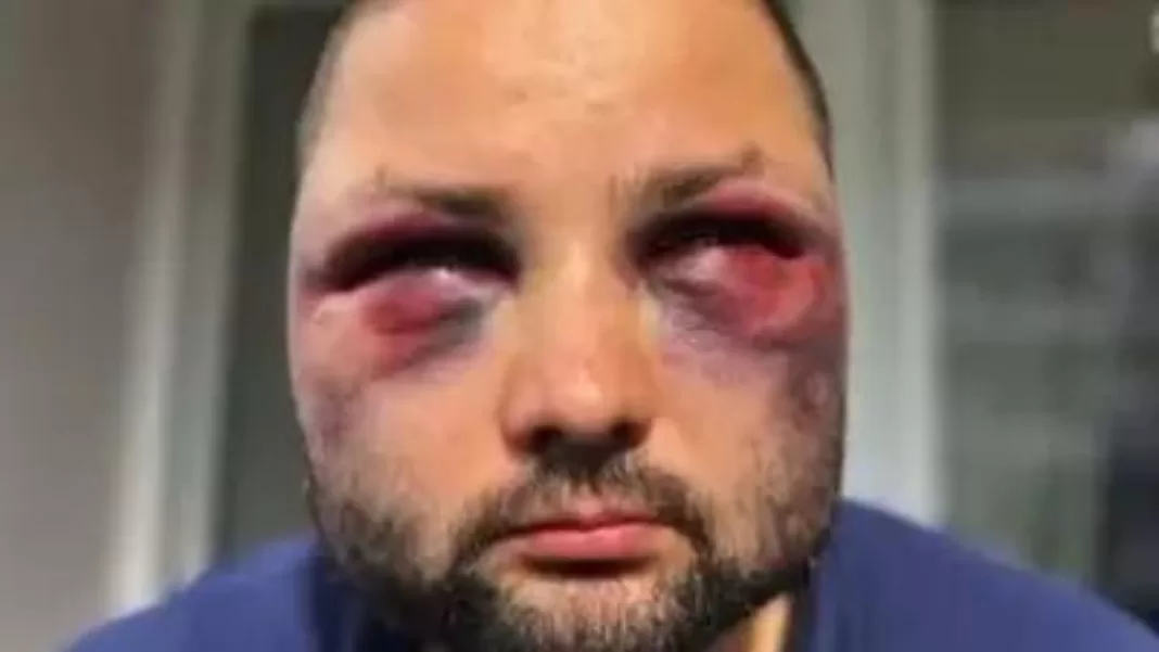 Lider AfD de origine română, candidat la Parlamentul bavarez, desfigurat