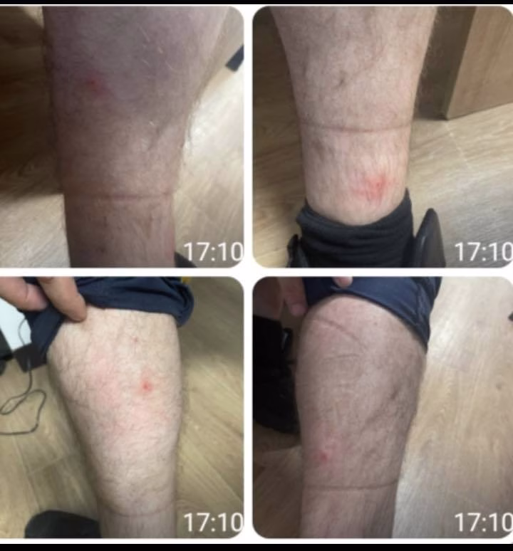 Ploșnițele au invadat Poliția Capitalei: 10 polițiști au ajuns la UPU